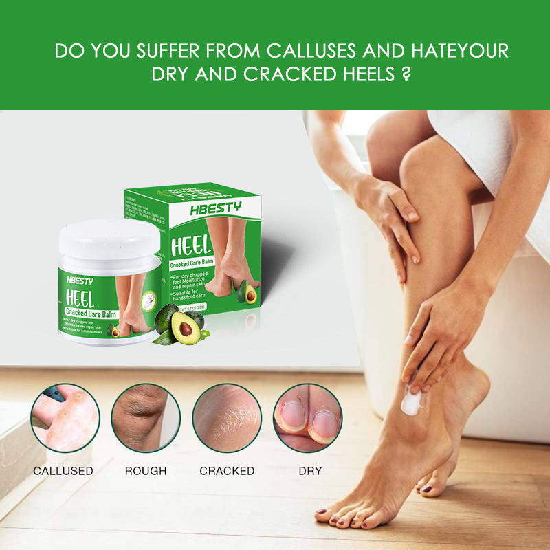 Buy Avocado Heel Cracking Cream to Repair Dry and Cracked Heels global swanky 3