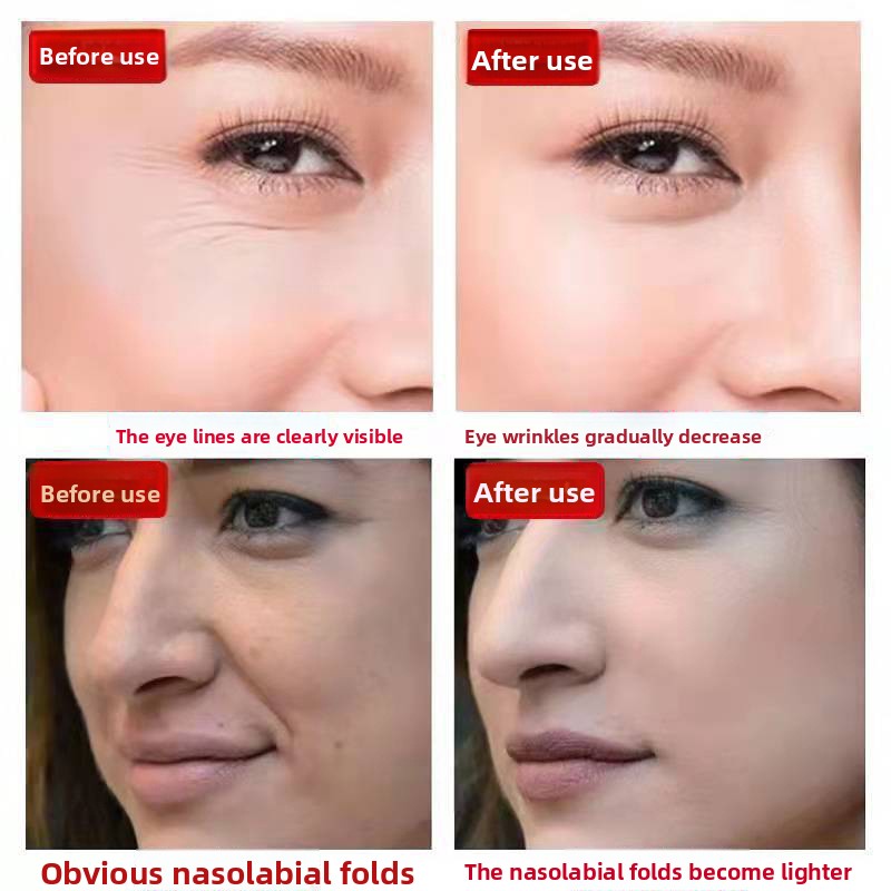 Collagen Filling Cream Anti-Wrinkle Firming Moisturizing Cream