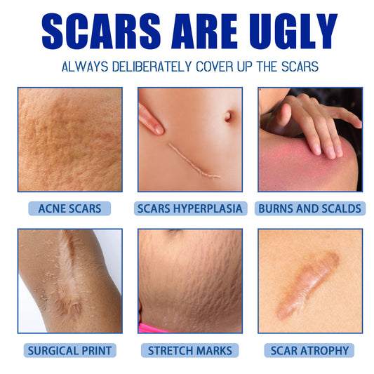 Scar Repair Cream for Smooth Even Looking Skin Care Daily