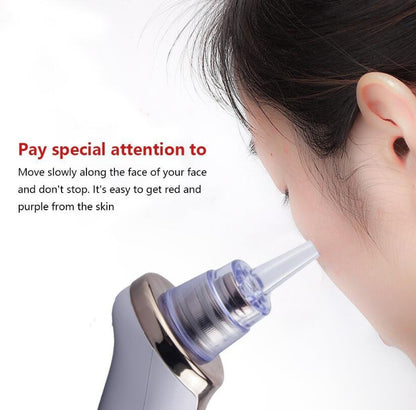 Buy Blackhead Pore Vacuum Cleaner – Suction Face Tool for Clear Skin