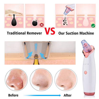 Buy Blackhead Pore Vacuum Cleaner – Suction Face Tool for Clear Skin