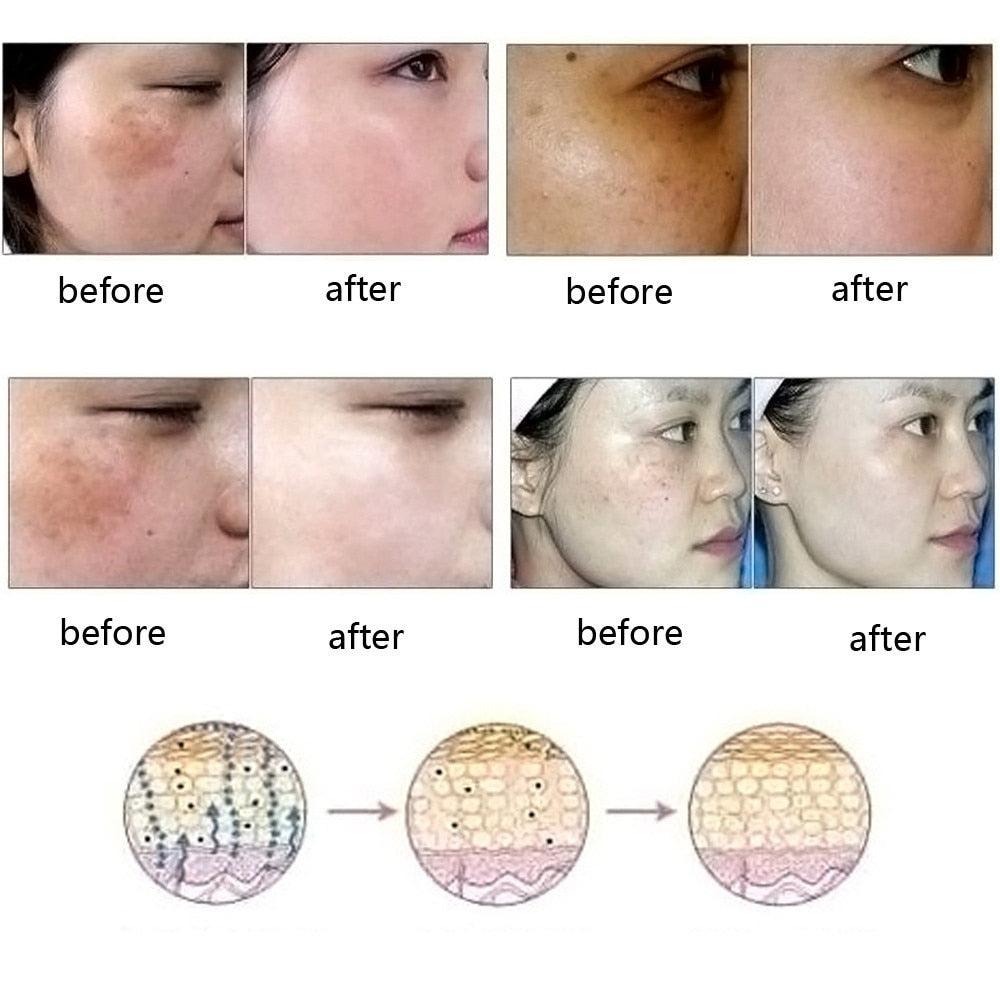 Buy Ultra Brightening Spotless Oil – Fade Dark Spots & Even Skin