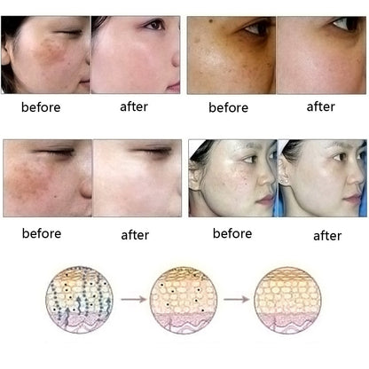 Buy Ultra Brightening Spotless Oil – Fade Dark Spots & Even Skin