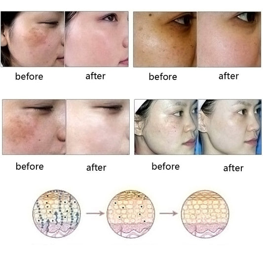 Buy Ultra Brightening Spotless Oil – Fade Dark Spots & Even Skin