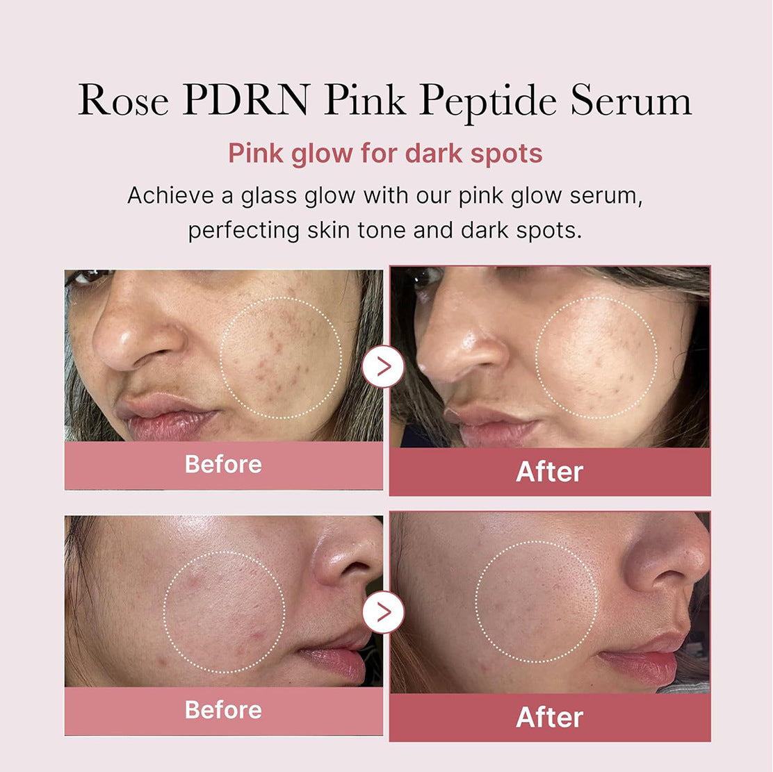Pink Peptide Collagen Ampoule Essence PDRN Serum Facial Care