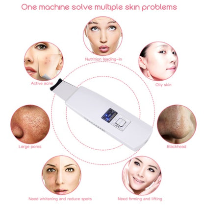 Buy Ultrasonic Skin Scrubber – Blackhead & Acne Removal Facial Spa