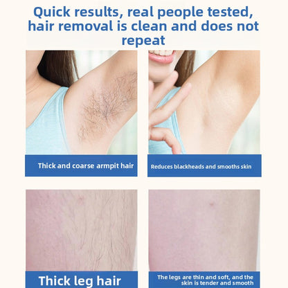 IPL Laser Hair Removal Device for Smooth Skin Care at Home