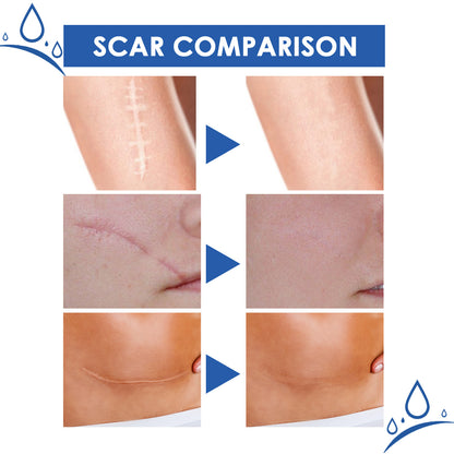 Scar Repair Cream for Smooth Even Looking Skin Care Daily