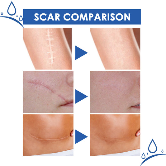Scar Repair Cream for Smooth Even Looking Skin Care Daily