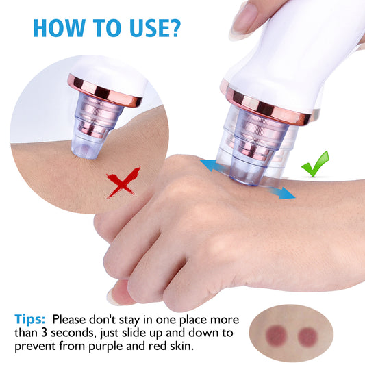 Blackhead Pore Vacuum Cleaner – Suction Face Tool for Clear Skin globalswanky 03