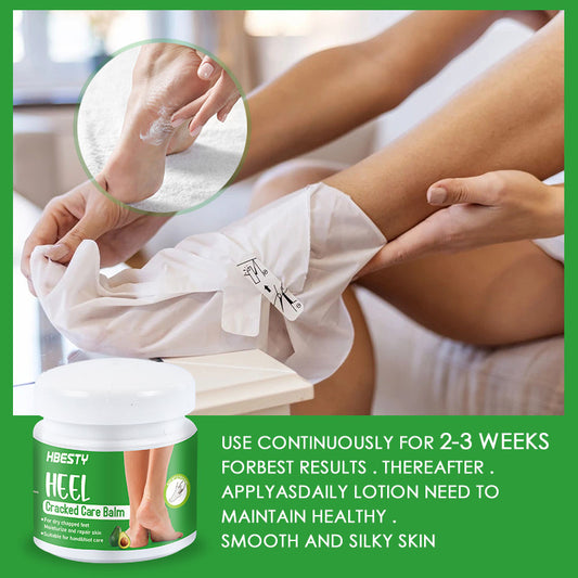 Buy Avocado Heel Cracking Cream to Repair Dry and Cracked Heels global swanky 1