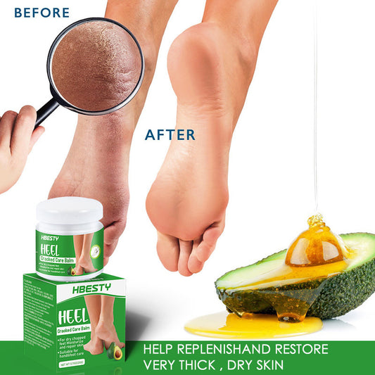 Buy Avocado Heel Cracking Cream to Repair Dry and Cracked Heels global swanky 2