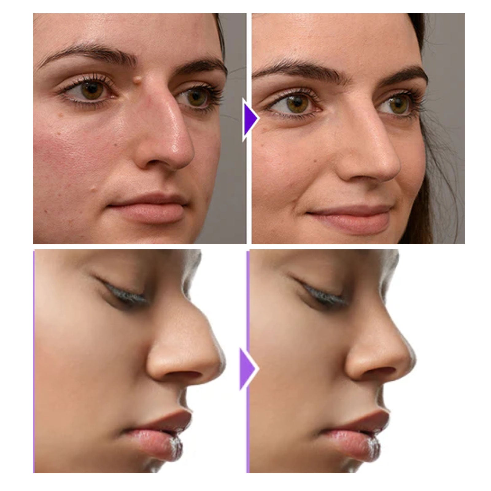 Buy Eelhoe Nose Shaper Tool for Perfect Nose Shape & Contour global swanky 2