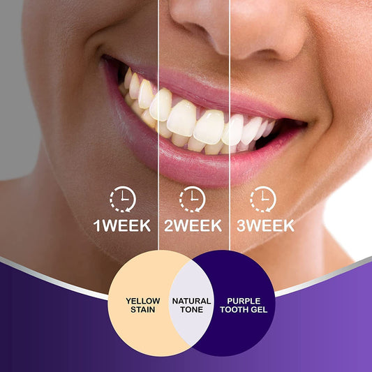Buy Hismiles V34 Purple Mint Toothpaste for Bright Teeth global swanky 3
