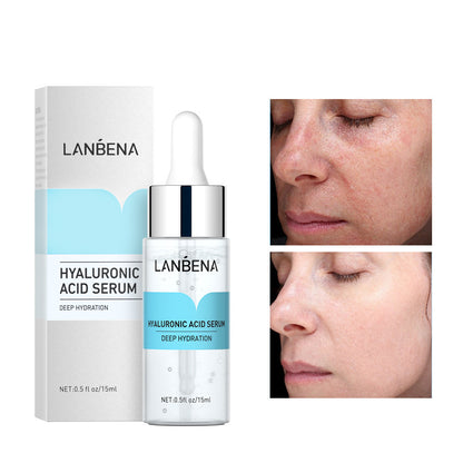 Hyaluronic Acid Vitamin C Serum for 0Hydrated, Glowing Skin Global Swanky 3