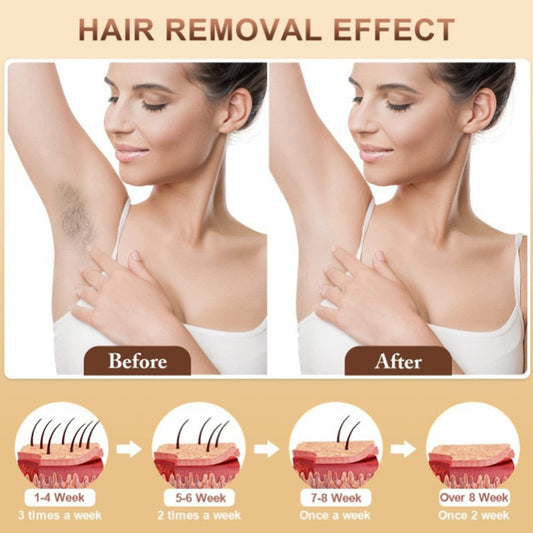 IPL Laser Hair Removal Device Smooth Skin Care at Home Global Swanky 2