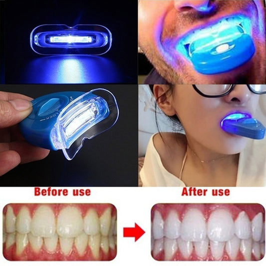 Teeth Whitening Kit for Bright Smile Daily Oral Care Routine globalswanky 01