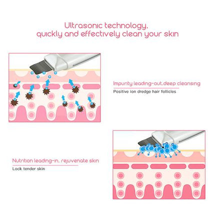 Ultrasonic Skin Scrubber – Blackhead & Acne Removal Facial Spa globalswanky 03