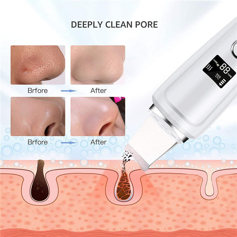 Ultrasonic Skin Scrubber for Deep Pore Facial Cleaning Use globalswanky 02
