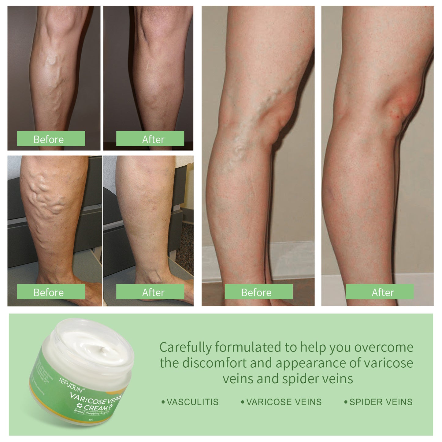 Vein Relief Massage Serum – Soothes Legs & Boosts Circulation global swanky 4
