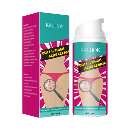 Acne Clearing Cream