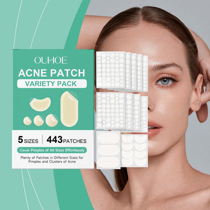Acne Concealer Paste