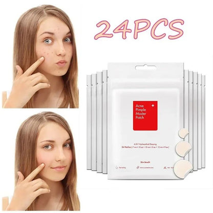 Acne Patch Sheets