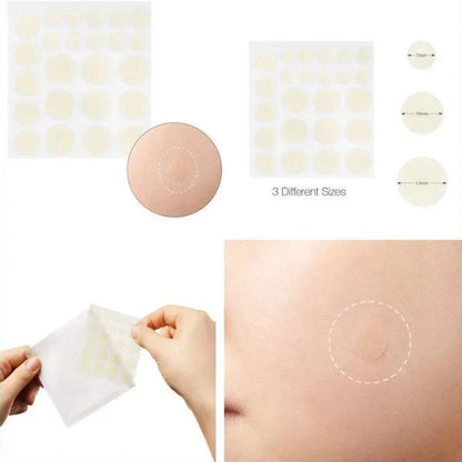 Acne Patch Sheets