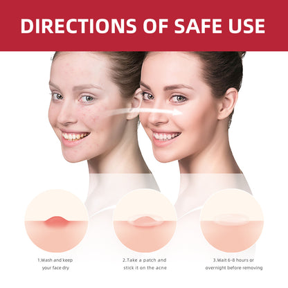 Acne Patches