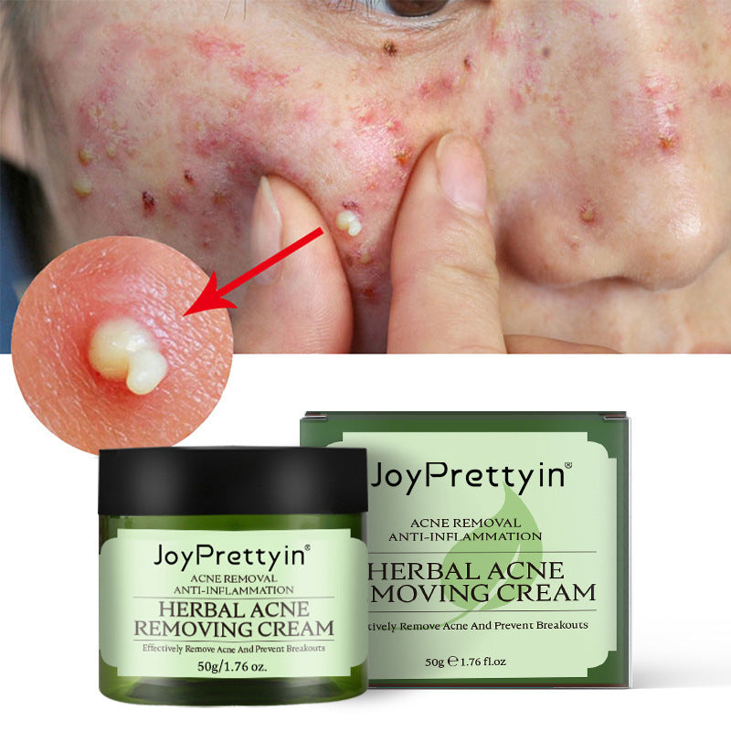 Acne Repair Cream