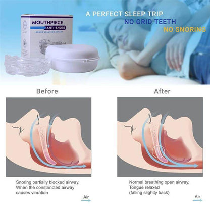 Adjustable anti-snoring mouthpiece