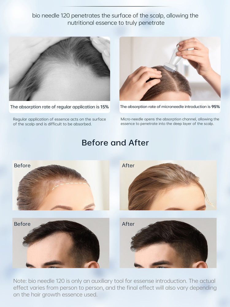 Adjustable Microneedle Stamp for Hair Growth