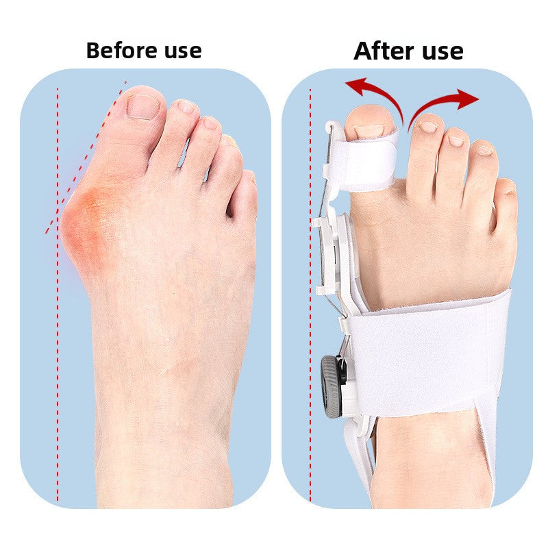 Adjustable Toe Separator Orthosis