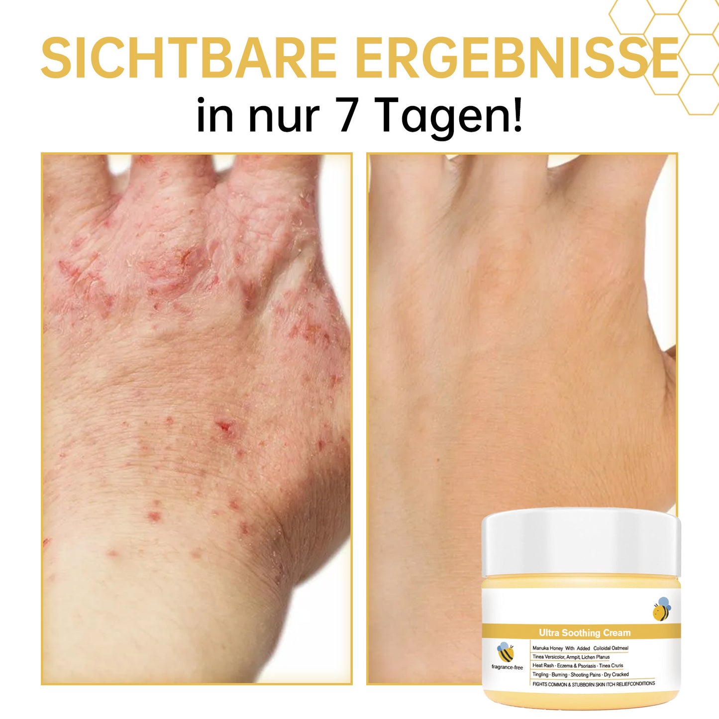 Anti-Itch Honey Cream