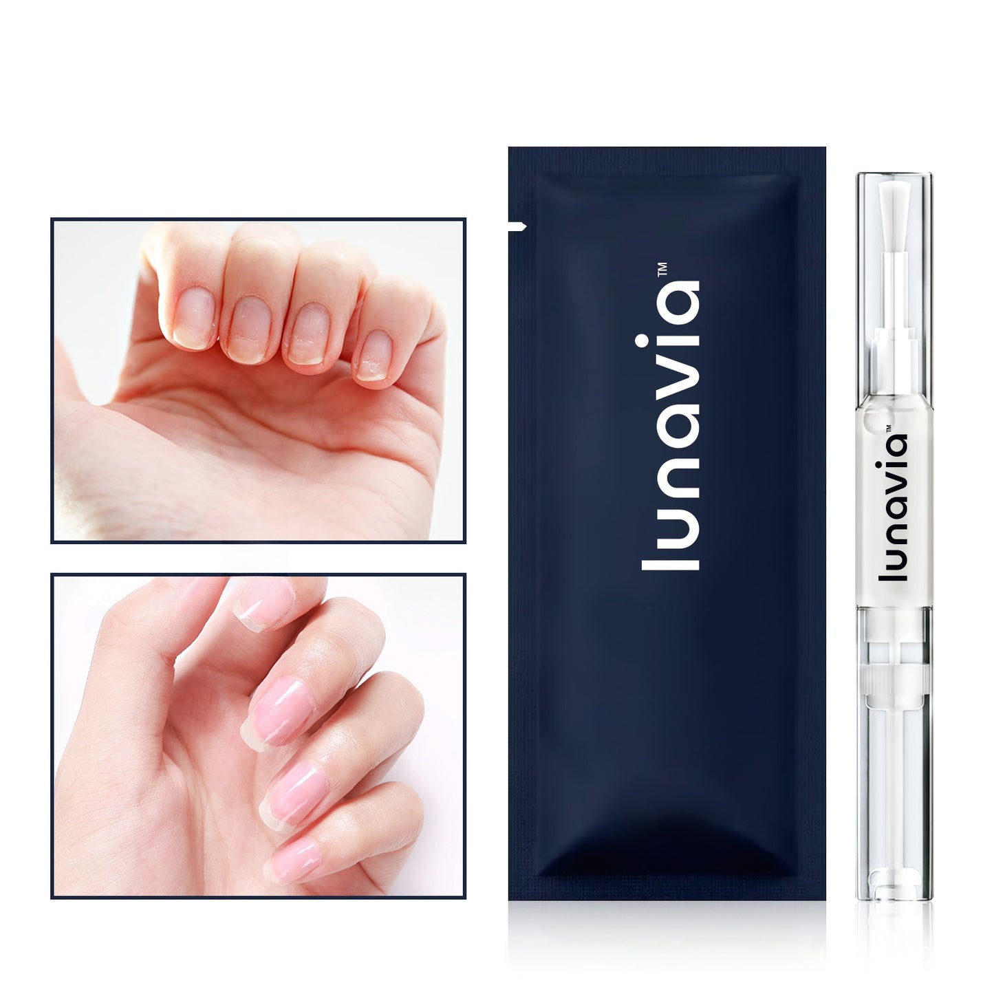 antifungal pen