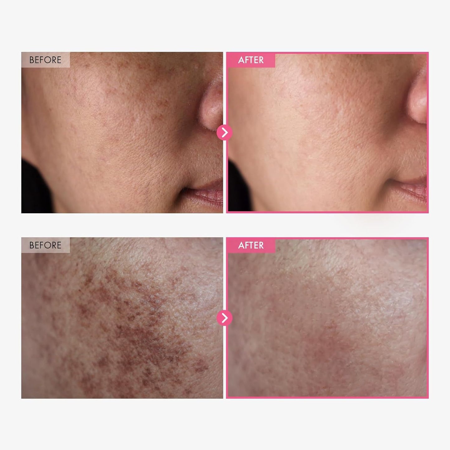 Arbutin Nicotinamide Cream
