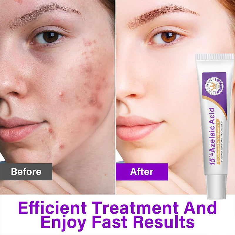 Azelaic Acid Facial Essence for Acne Scar Treatment