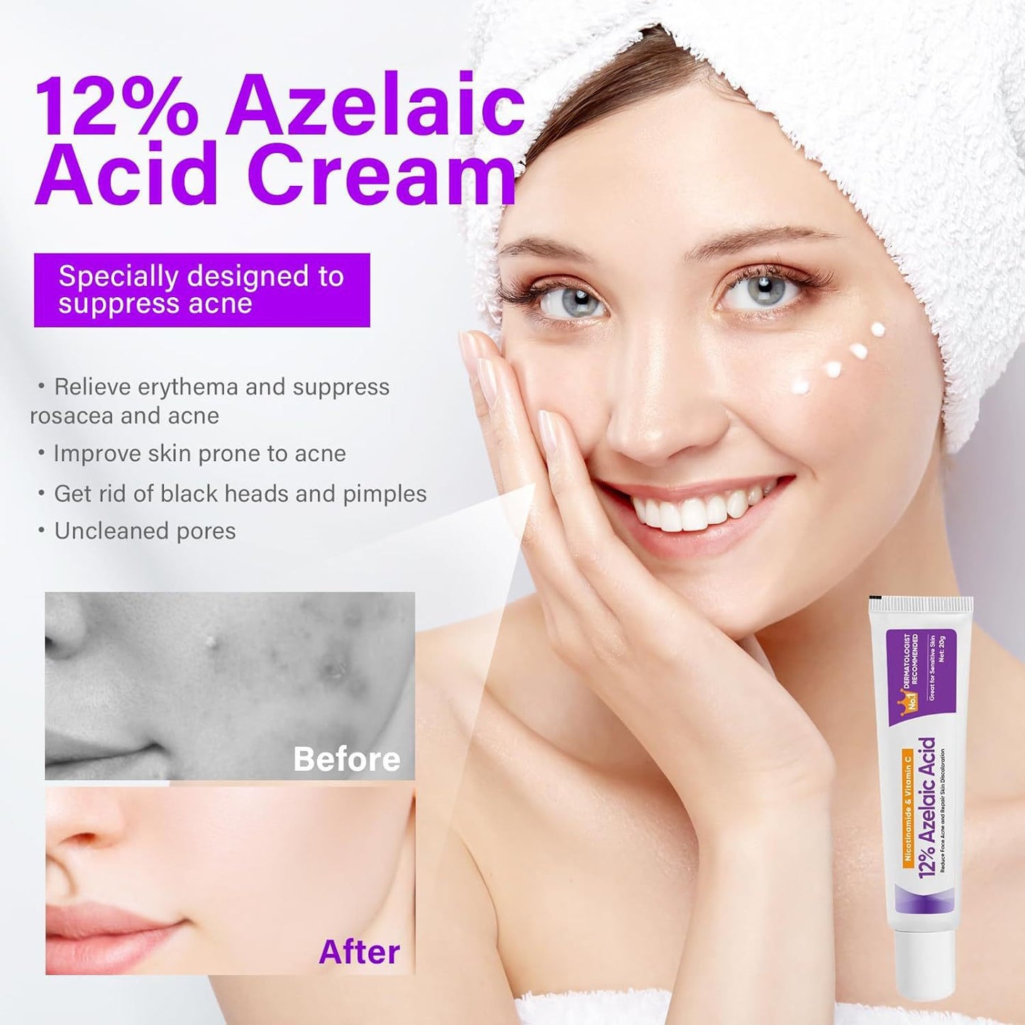 Azelaic Acid Gel