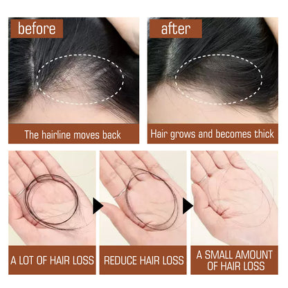 Battana Oil Hair Conditioner