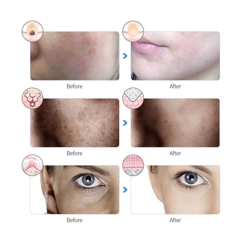 Beauty mask