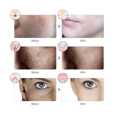 Beauty mask