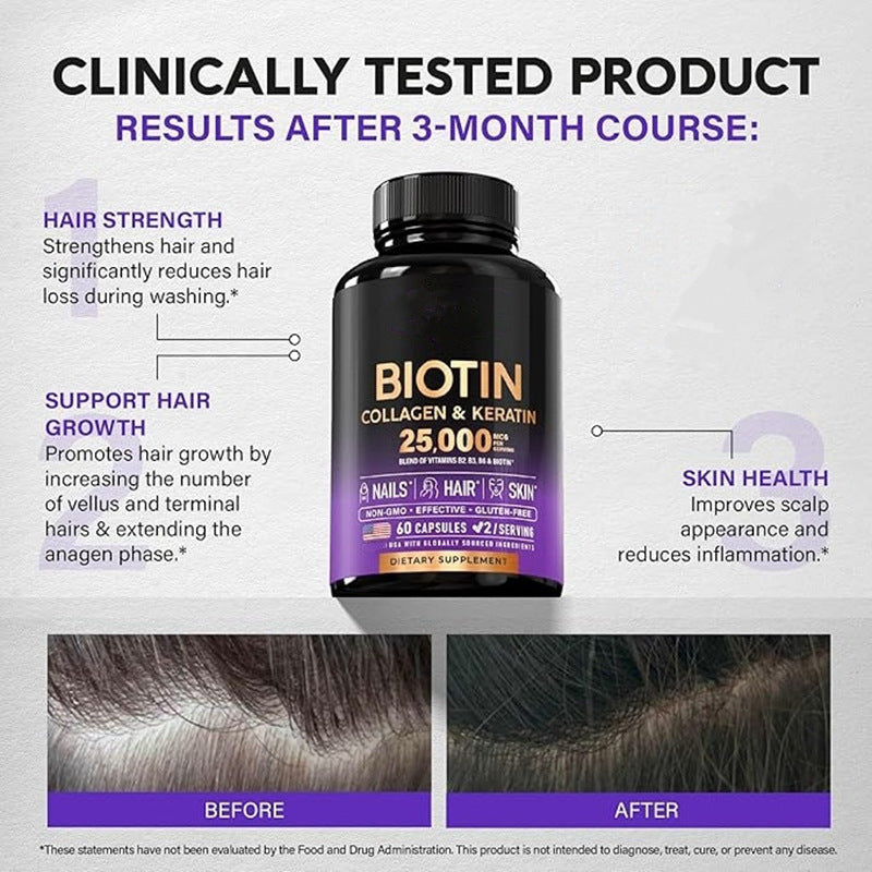 biotin capsules