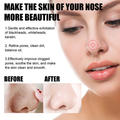 Blackhead Peel-Off Nasal Mask