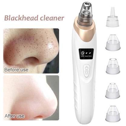 Blackhead Remover