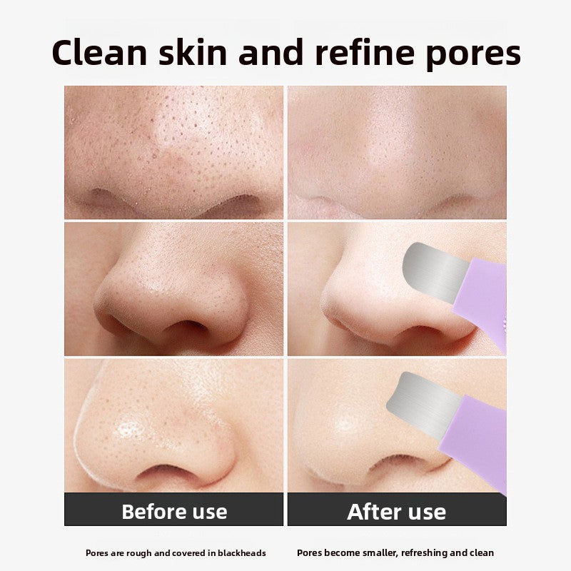 Blackhead Remover ToolFacial Beauty Safety Tool