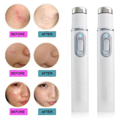 Blue Light Anti-Pimple Pen