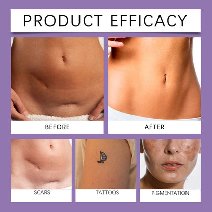 Body Coverage Concealer Cream