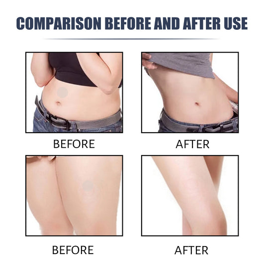 Body Shaping Patch