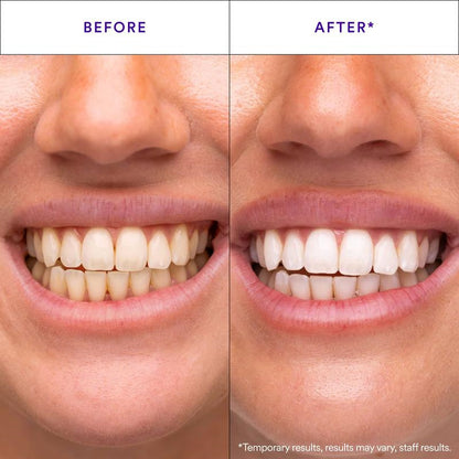 Care Tooth Patch