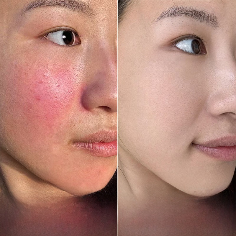 Centella Asiatica Repair Cream
